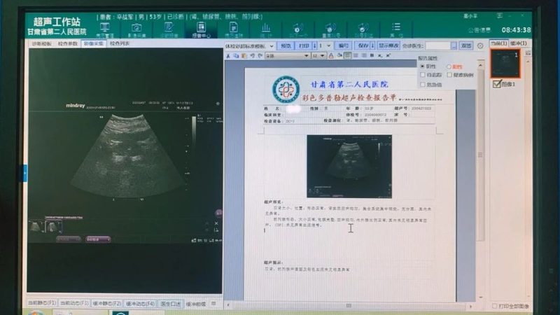 女性体检应重点关注以下项目：